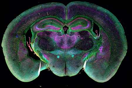 Service Life and Maintenance of a Constant Temperature Shaking Incubator